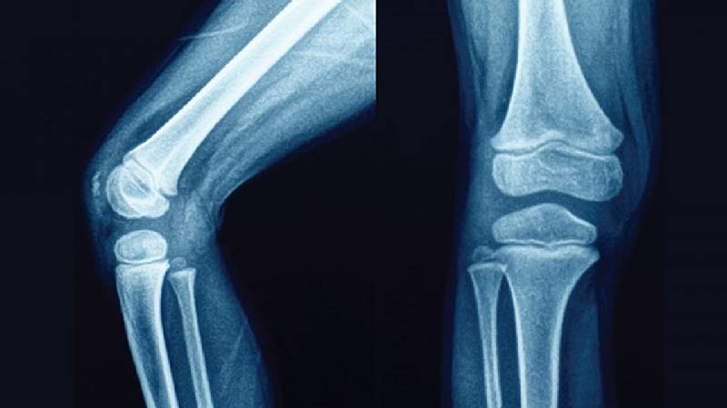 Joint/Bone Health